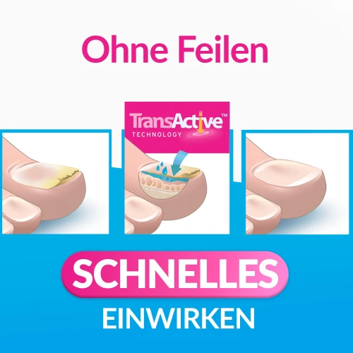  Lösung gegen Nagelpilz