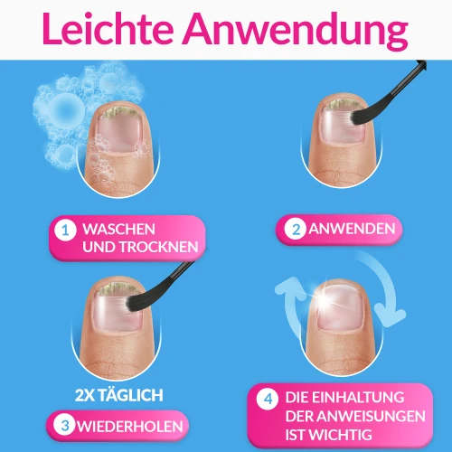  Lösung gegen Nagelpilz