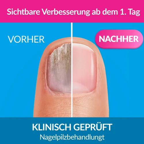 INTENSIV
