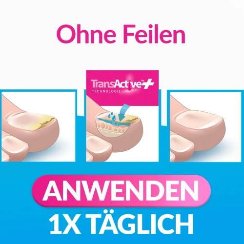 INTENSIV