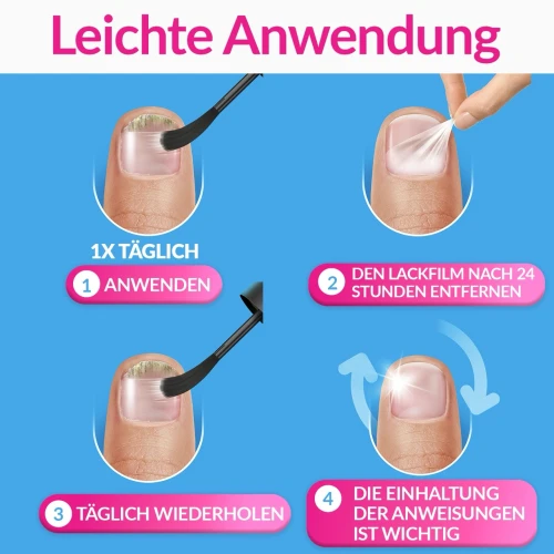 INTENSIV