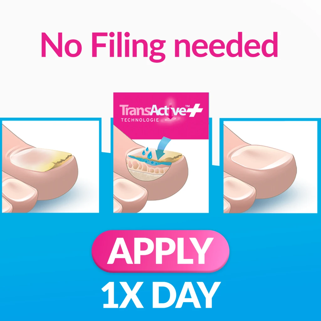 Excilor Nail Fungus Ultra for persistent nail fungus