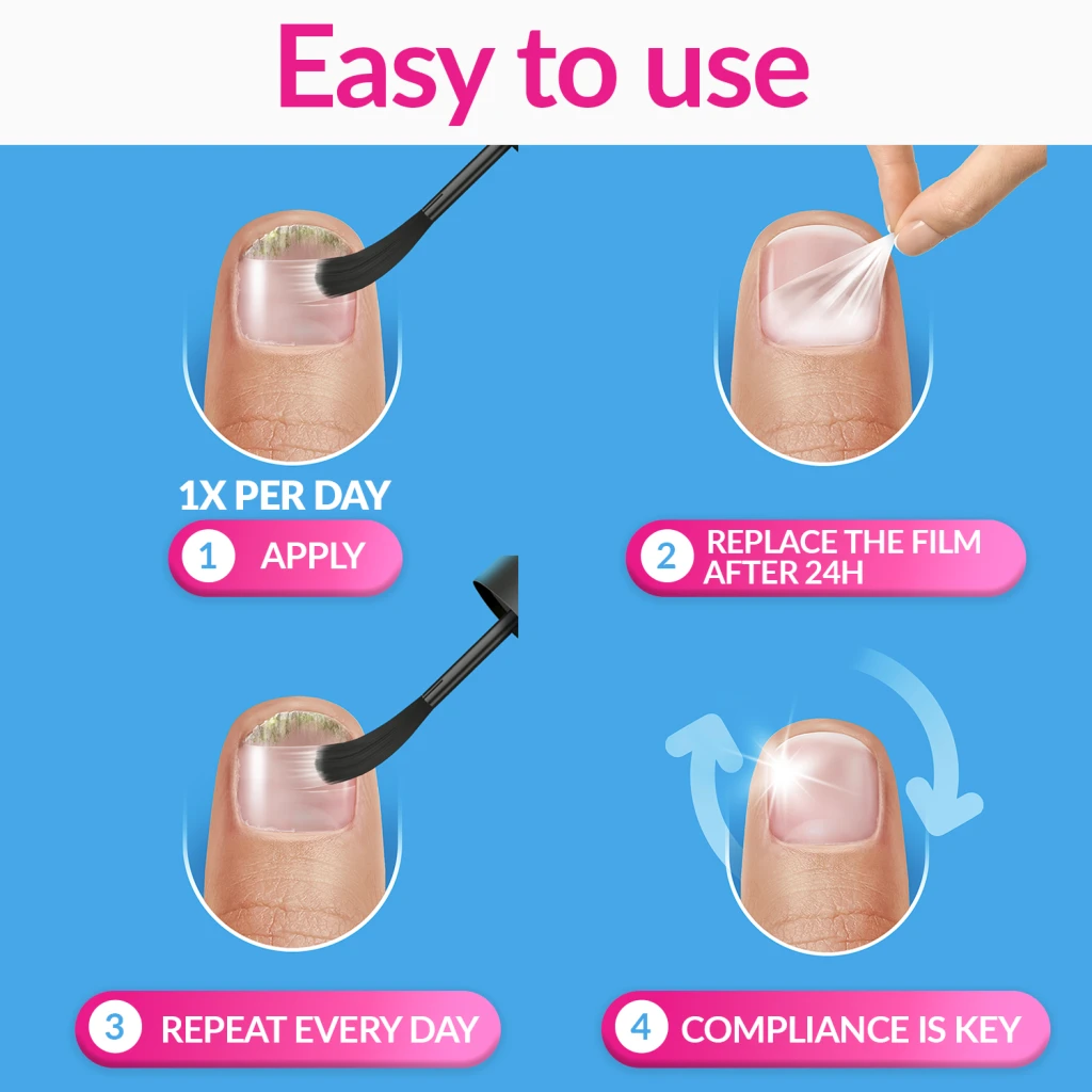 Excilor Nail Fungus Ultra for persistent nail fungus