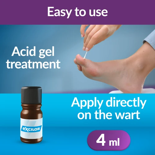  Warts Treatment