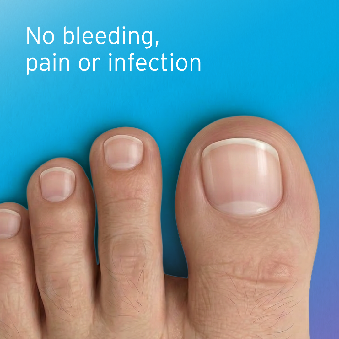 No pain or infection