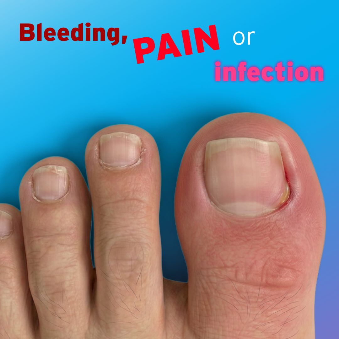 Pain / bleeding / infection