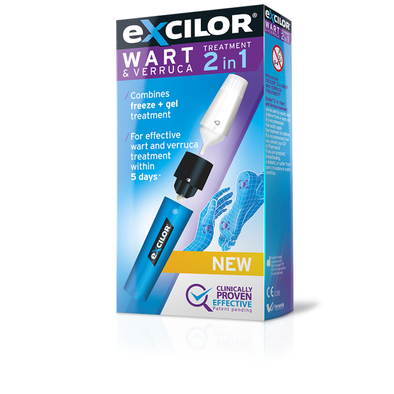 warts treatment uk